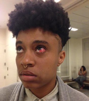 Stephanie Dorceant, after she says an off-duty cop beat her, then had her arrested for assault.
